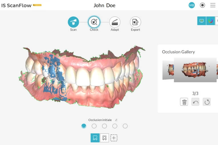 Milestone Scientific Dental_6